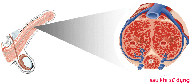 泰坦凝胶的实际作用