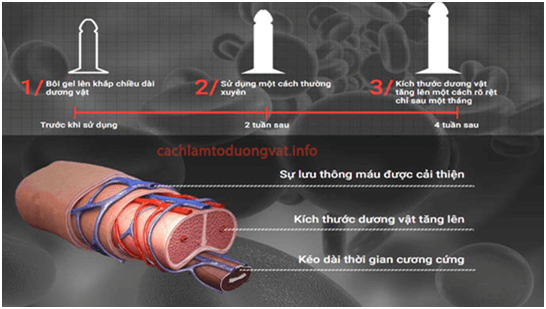 购买泰坦凝胶的承诺