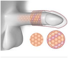 什么是泰坦凝胶 ，它由什么组成？怎样使用？