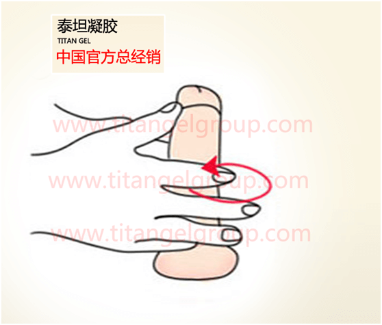 泰坦凝胶使用方法图