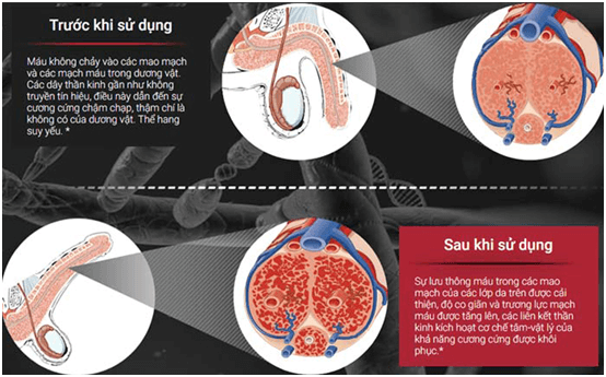 什么是泰坦凝胶？